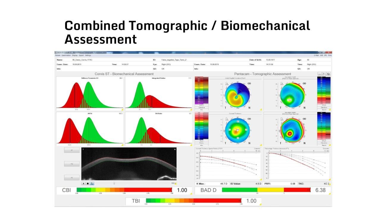 Biomeccanica.pptx (3).jpg